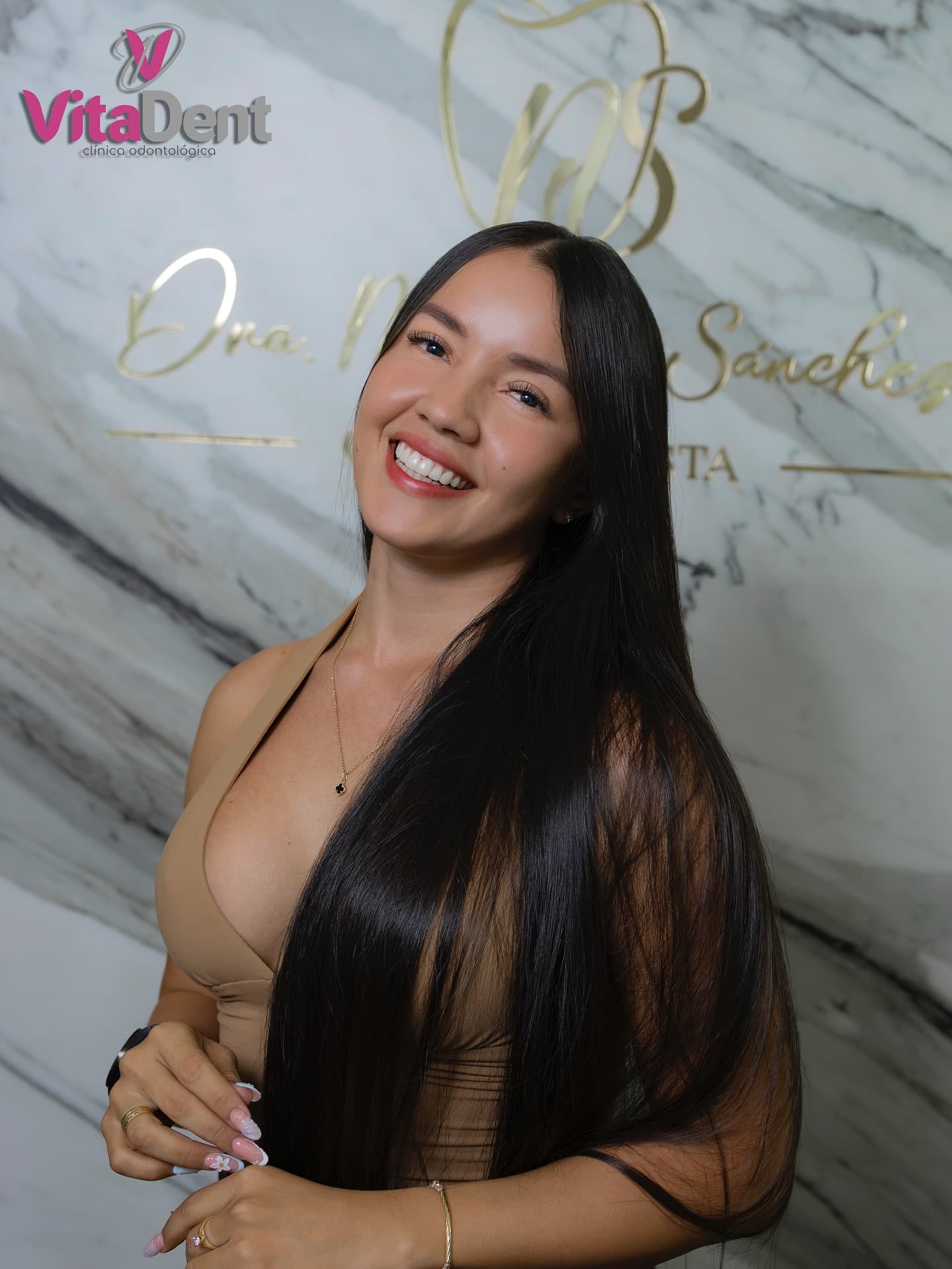 Resultado de diseño de sonrisa realizado en Vitadent Clínica Odontológica